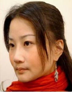 凡是与美 - 凡是与美B&A - 【鼻子】定制鼻整形 后