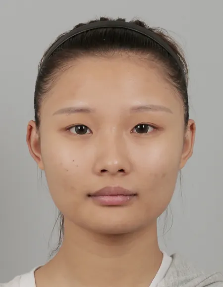 凡是与美 - B&A - 全脸改造 前