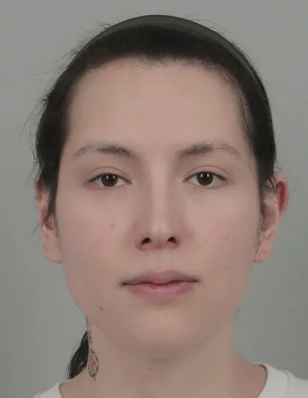 凡是与美 - B&A - 鼻部手术与鼻整形 前