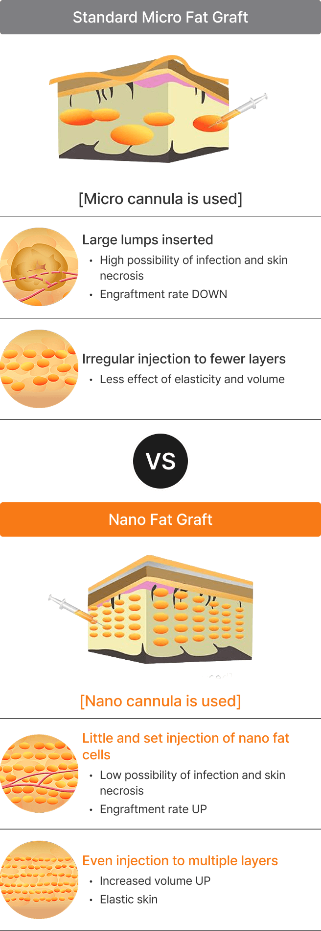 凡是与美 - Fat Graft - 多层均匀注射