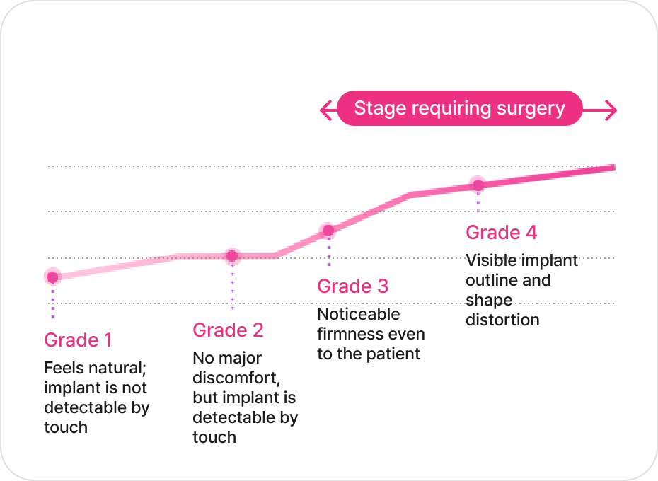 凡是与美 - 胸部 Revision - Stage-by-Stage Symptoms 包膜挛缩