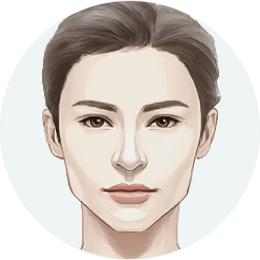 凡是与美 - 女性化面部手术 - 案例02:鼻尖宽、鹰钩鼻或鼻梁低者。