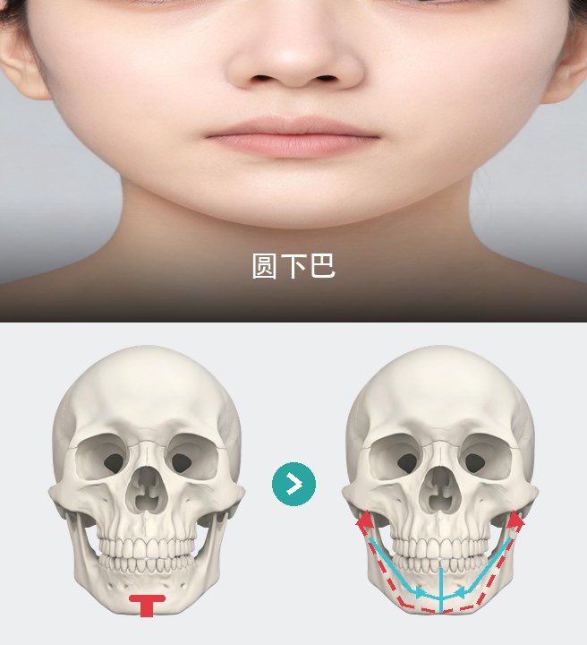 圆下巴