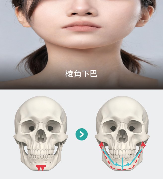 棱角下巴