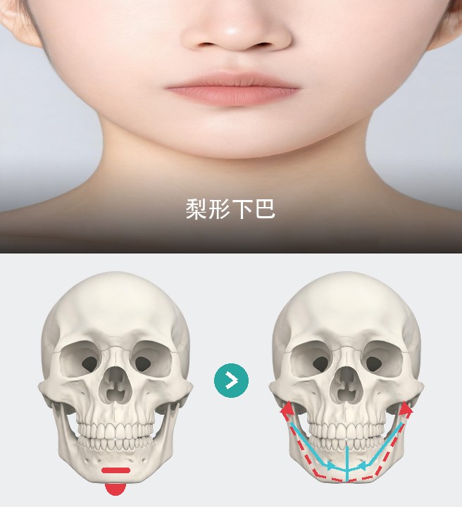 梨形下巴
