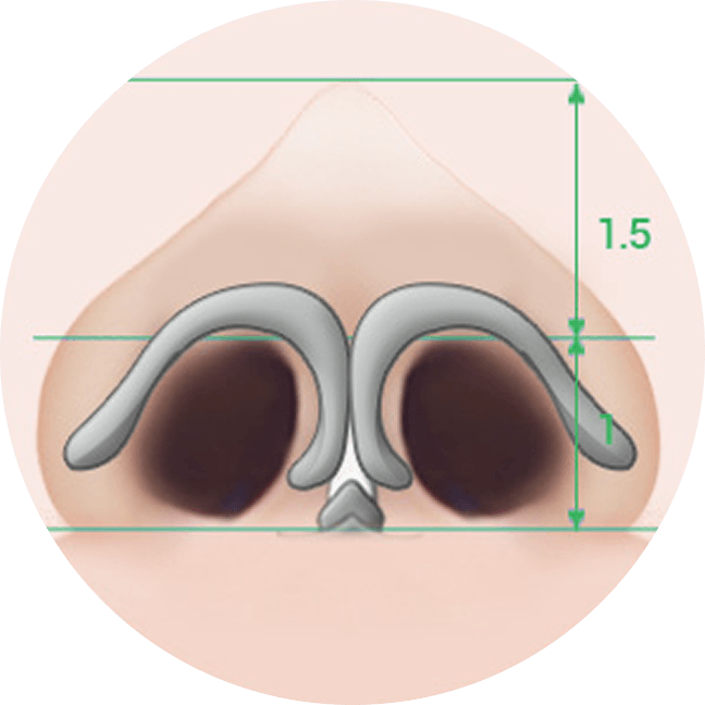 凡是与美 - Asian Rhinoplasty - 常规鼻部整形鼻尖