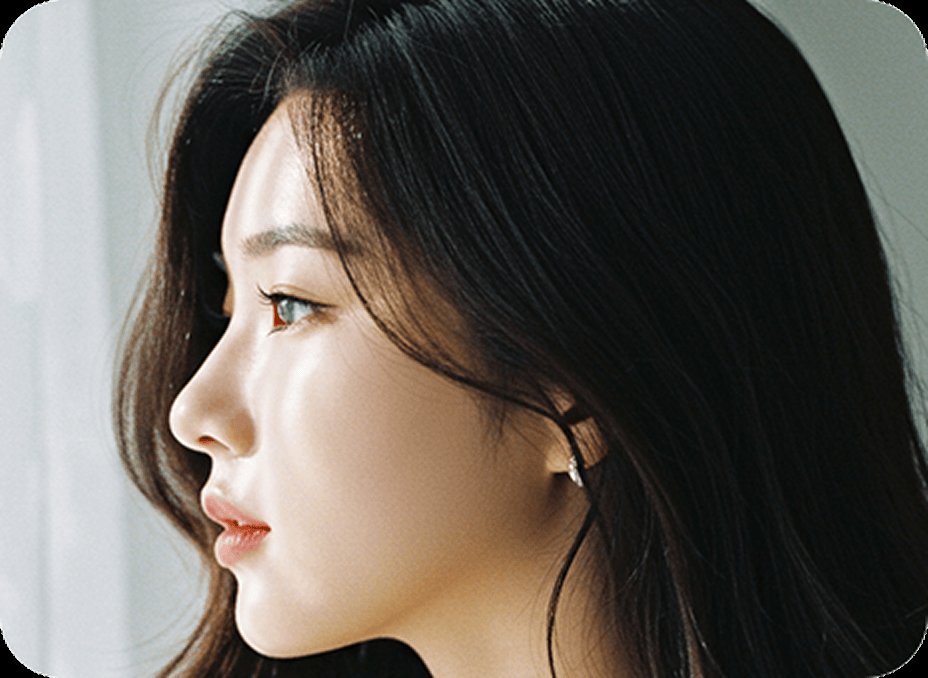 凡是与美 - Rhinoplasty - 自然鼻梁