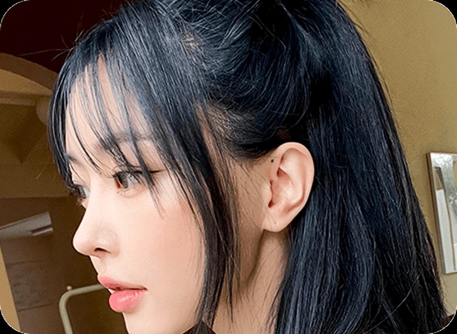 凡是与美 - Rhinoplasty - 精致鼻尖