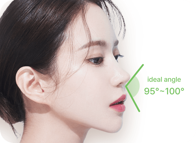 凡是与美 - Rhinoplasty - 自然鼻唇线条