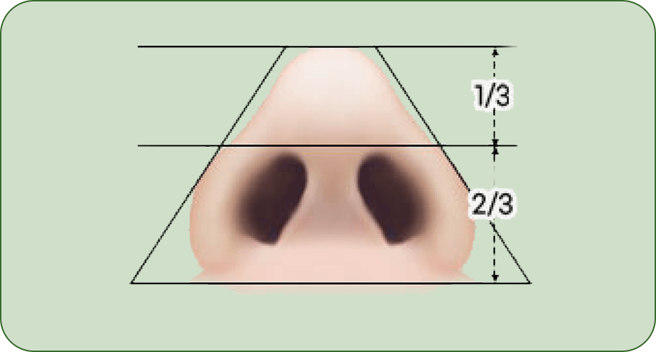 凡是与美 - Rhinoplasty - 芭比线条第2步