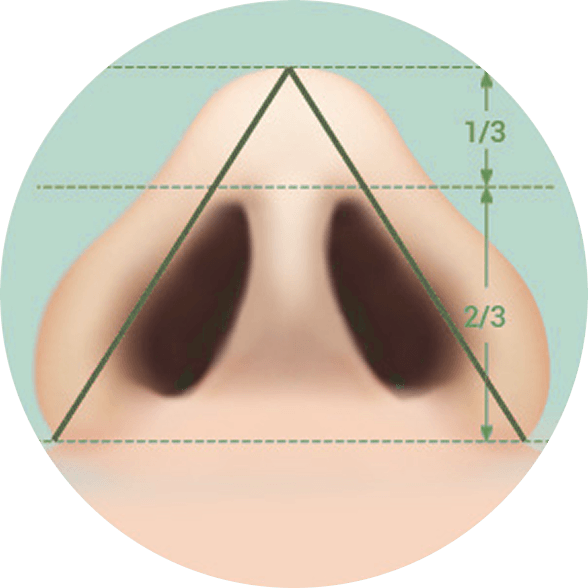 凡是与美 - Asian Rhinoplasty - 手术技术第3步