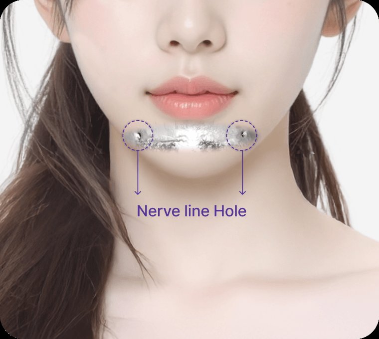 凡是与美 - 双鄂修复手术 - Safety with 3D-CT and 导航系统
