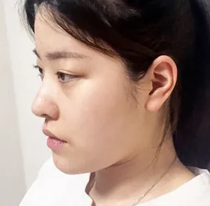 凡是与美 - 真实分享 - Kyunghee Lee - 1