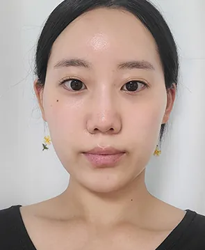 凡是与美 - 真实分享 - Chaeyeon Kwon - 1