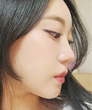 凡是与美 - 真实分享 - Chaeyeon Kwon - 4