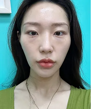 凡是与美 - 真实分享 - Seoyoon Lim - 1
