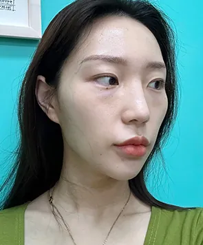 凡是与美 - 真实分享 - Seoyoon Lim - 2