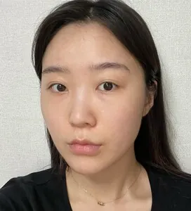 凡是与美 - 真实分享 - Emily - 1