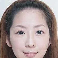 凡是与美 - 手术评价 - 慧敏