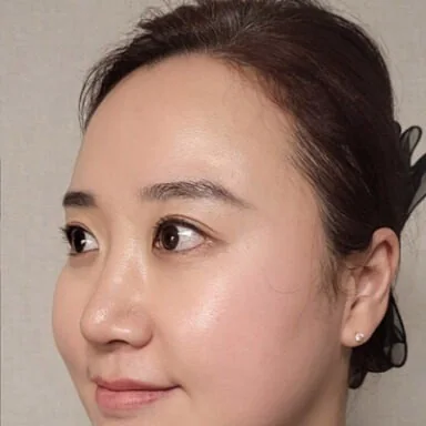 凡是与美 - 手术评价 - Lina