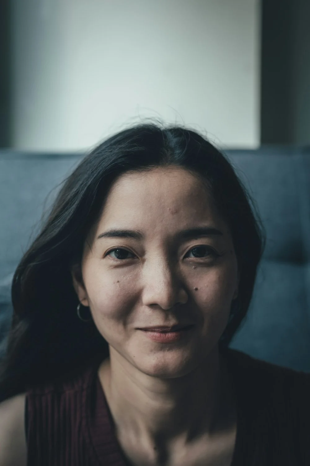 凡是与美 今日整形手术 - 欣怡